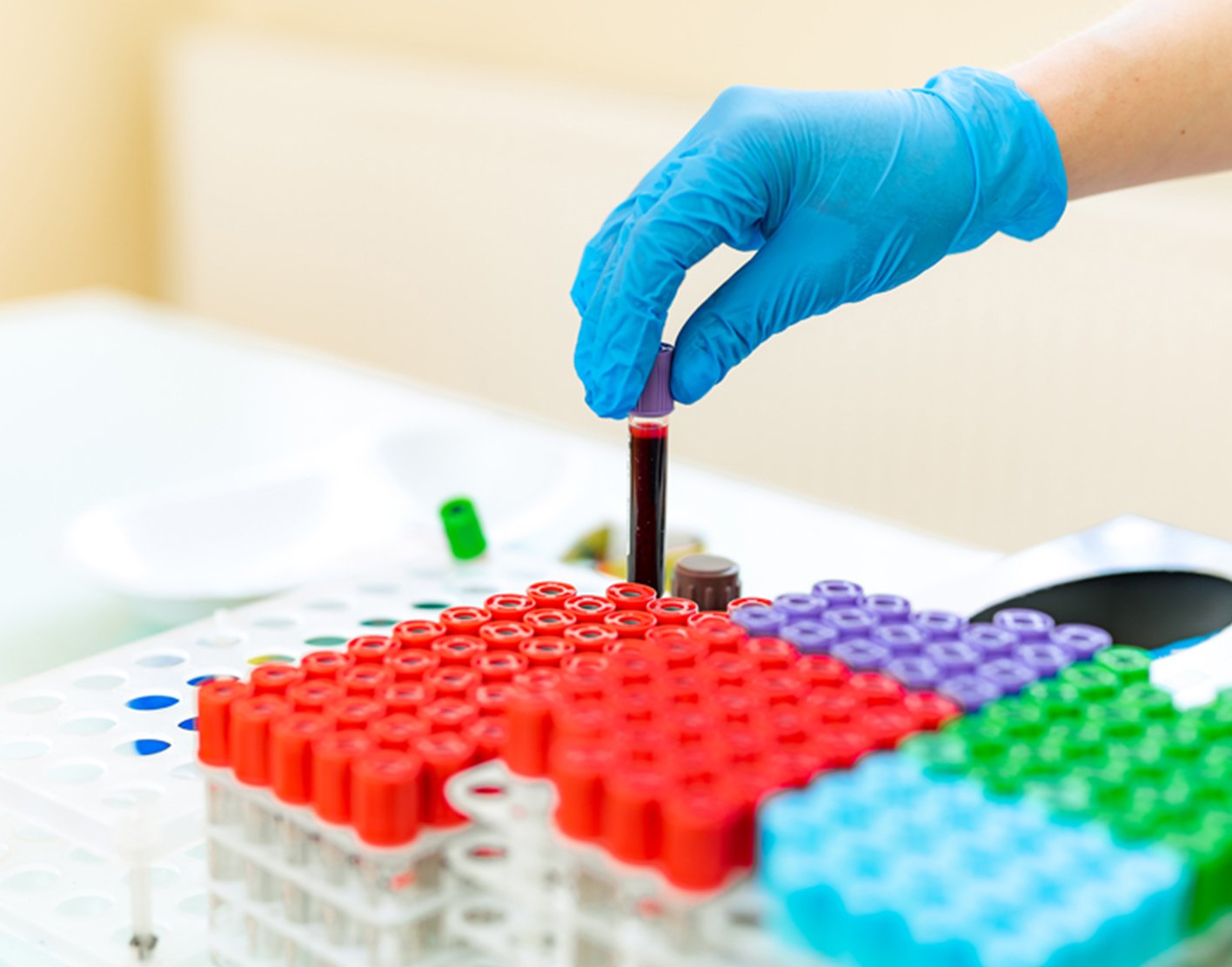 Blood Sugar Test