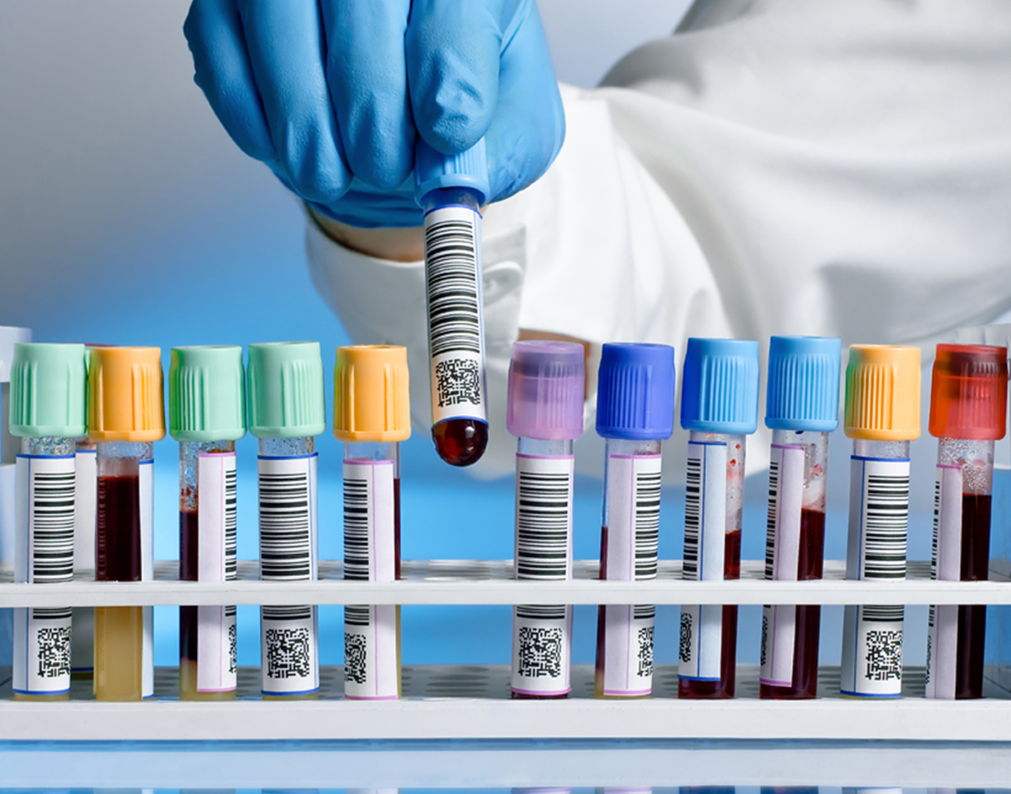 Comprehensive Metabolic Panel