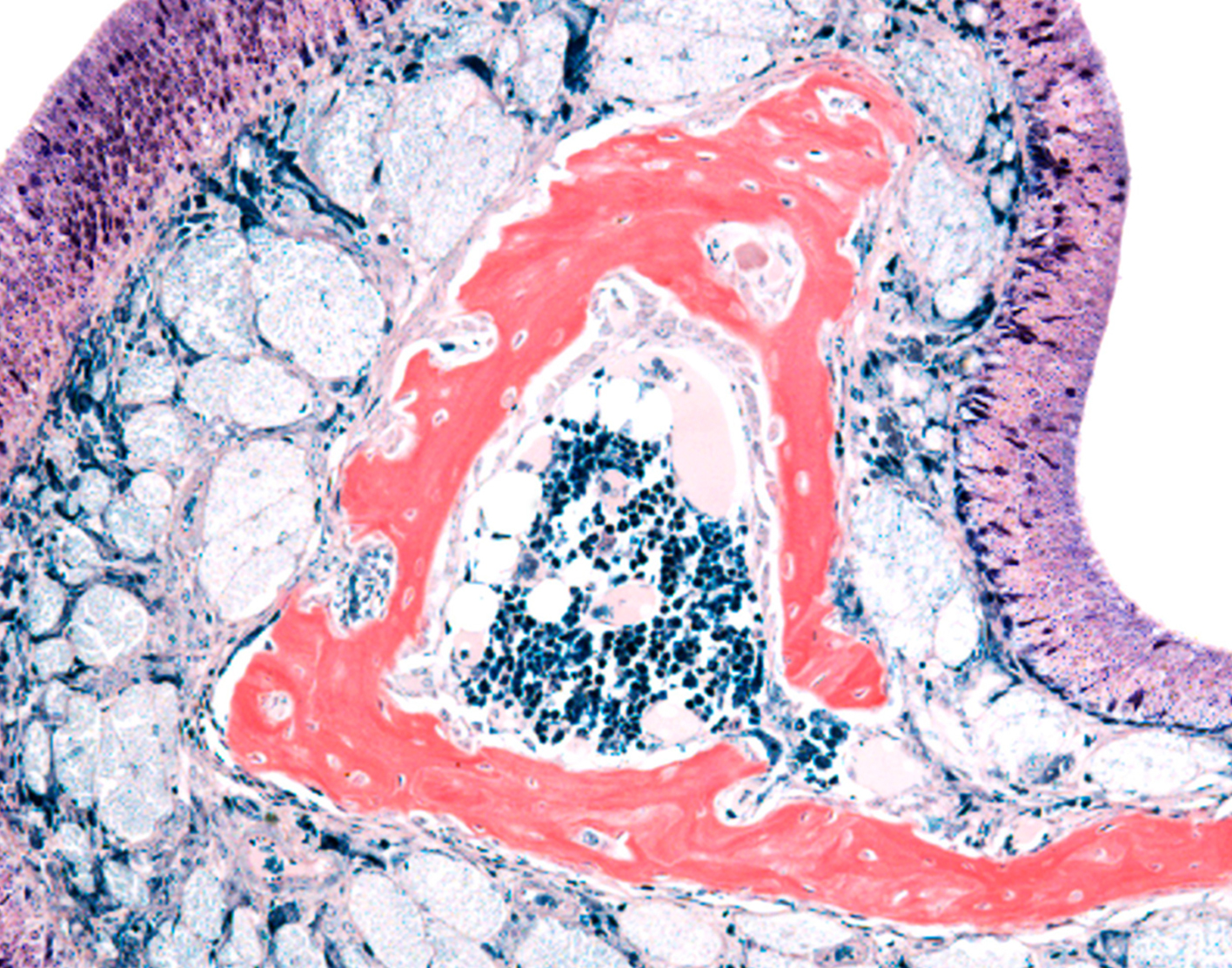 Nasal mucosal biopsy