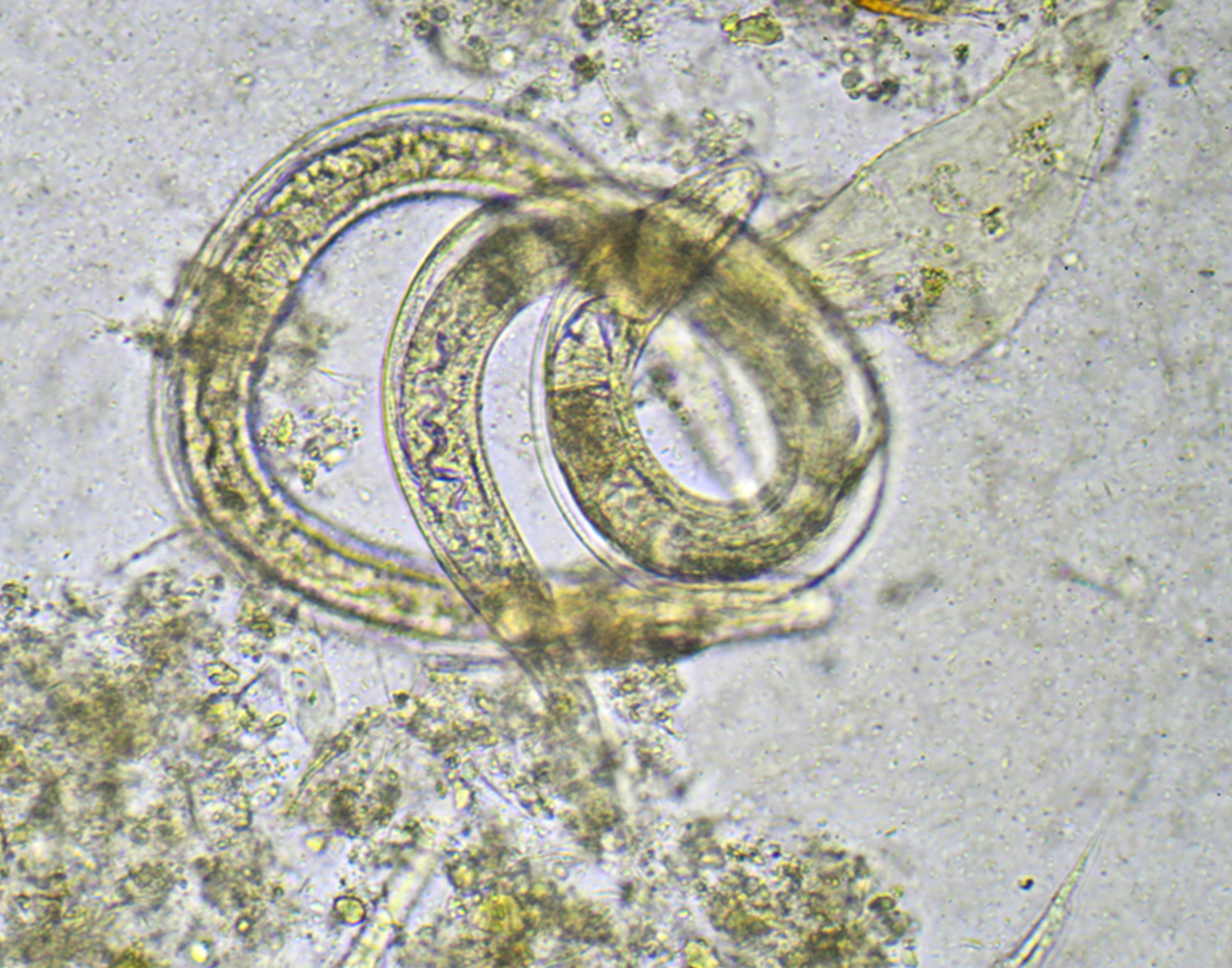 parasites in stool microscope