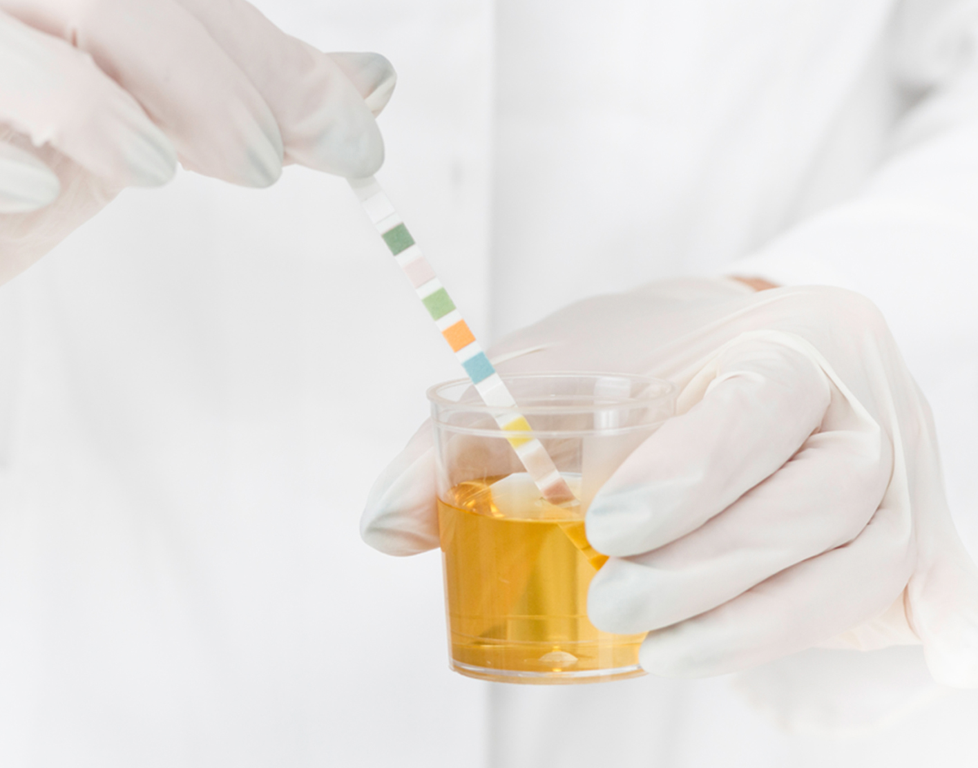 Urine pH test